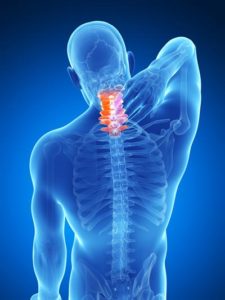 Whiplash injury illustration